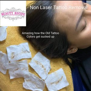 Non laser eyebrow tattoo phiremoval singapore