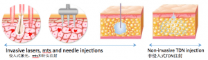 Needleless PDO Thread Lift now in Singapore 1
