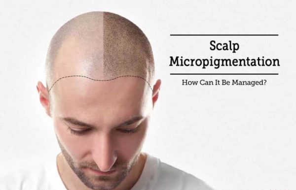 Scalp Micro-pigmentation / Hair Tattoo - Beauty RecipeBeauty Recipe