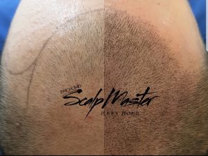 SMP Scalp Micropigmentation Course Singapore, jakarta, bangkok