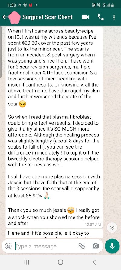 after plasma acne scar removal customer review