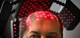 Low level laser therapy hair loss growth treatment singapore