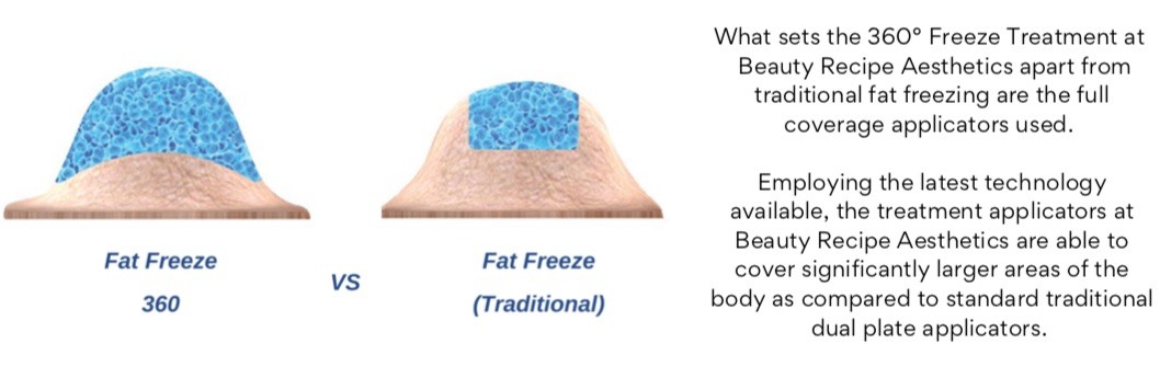 360 Fat Freeze slimming weightloss machine singapore