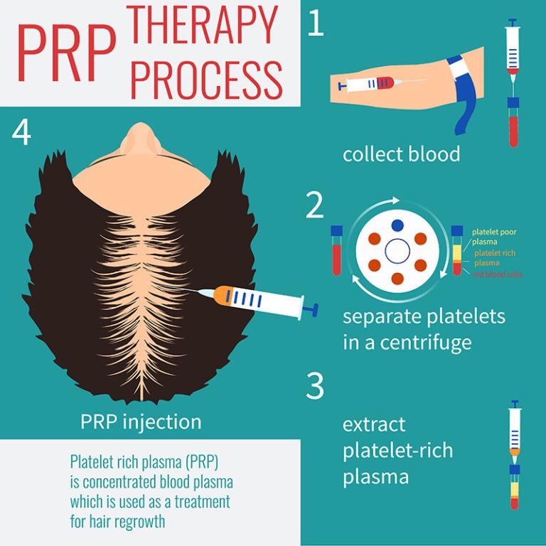 PRP Therapy Process